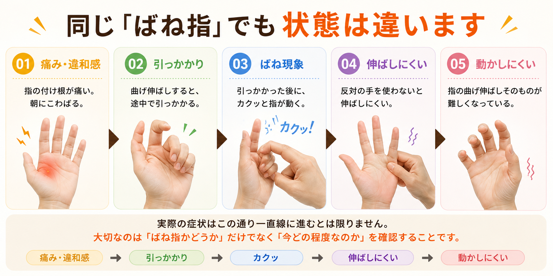ばね指の症状の進行